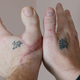 Illustration for article titled This Man Had His Thumb Replaced By His Toe